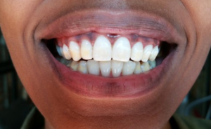 Kampala's Best Dental Clinic