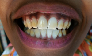 Precision Dental Clinic Kampala