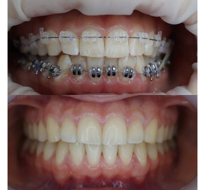 Precision dental Clinic
