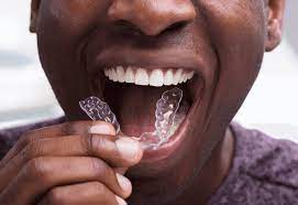 Precision Dental Clinic Invisalign Treatments