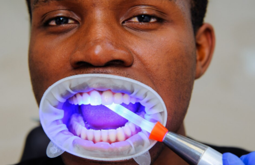 For Best Dental Care choose Precision Dental Clinic